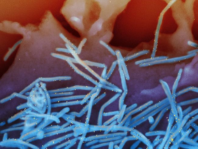 Officials investigate rare nervous system disorder in older adults who got RSV vaccine | iNFOnews.ca Officials investigate rare nervous system disorder in older adults who got RSV vaccine | iNFOnews.ca