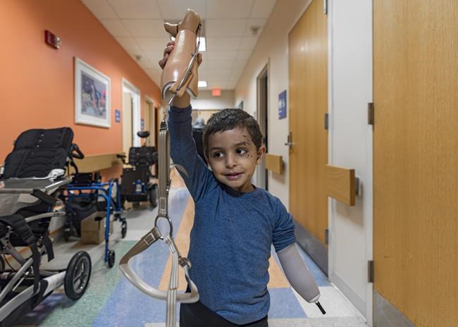 A 4-year-old Gaza boy lost his arm – and his family. Half a world away, he’s getting a second chance | iNFOnews.ca A 4-year-old Gaza boy lost his arm – and his family. Half a world away, he’s getting a second chance | iNFOnews.ca