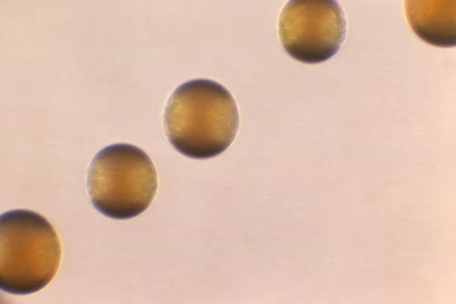 US officials warn of increase in bacterial illnesses that can lead to meningitis and possibly death | iNFOnews.ca US officials warn of increase in bacterial illnesses that can lead to meningitis and possibly death | iNFOnews.ca