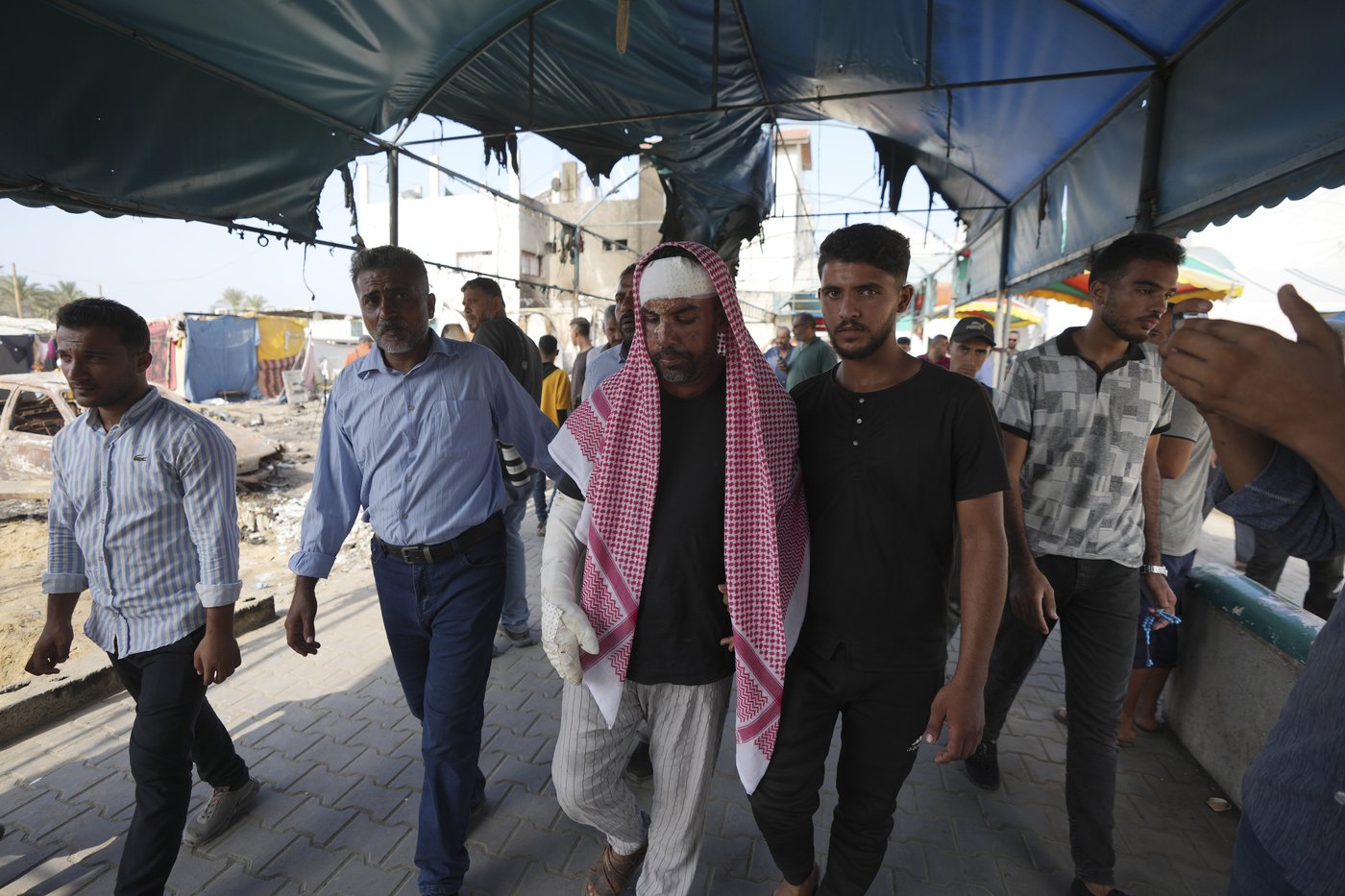 A Palestinian student was asleep in his tent at a hospital when an Israeli strike brought an inferno | iNFOnews.ca