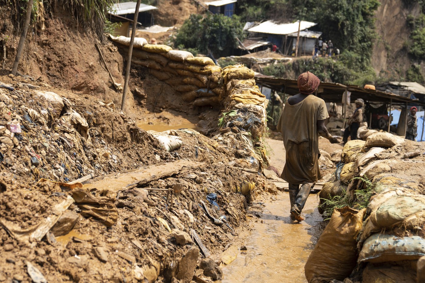 A gold mining town in Congo has become an mpox hot spot as a new strain spreads | iNFOnews.ca A gold mining town in Congo has become an mpox hot spot as a new strain spreads | iNFOnews.ca