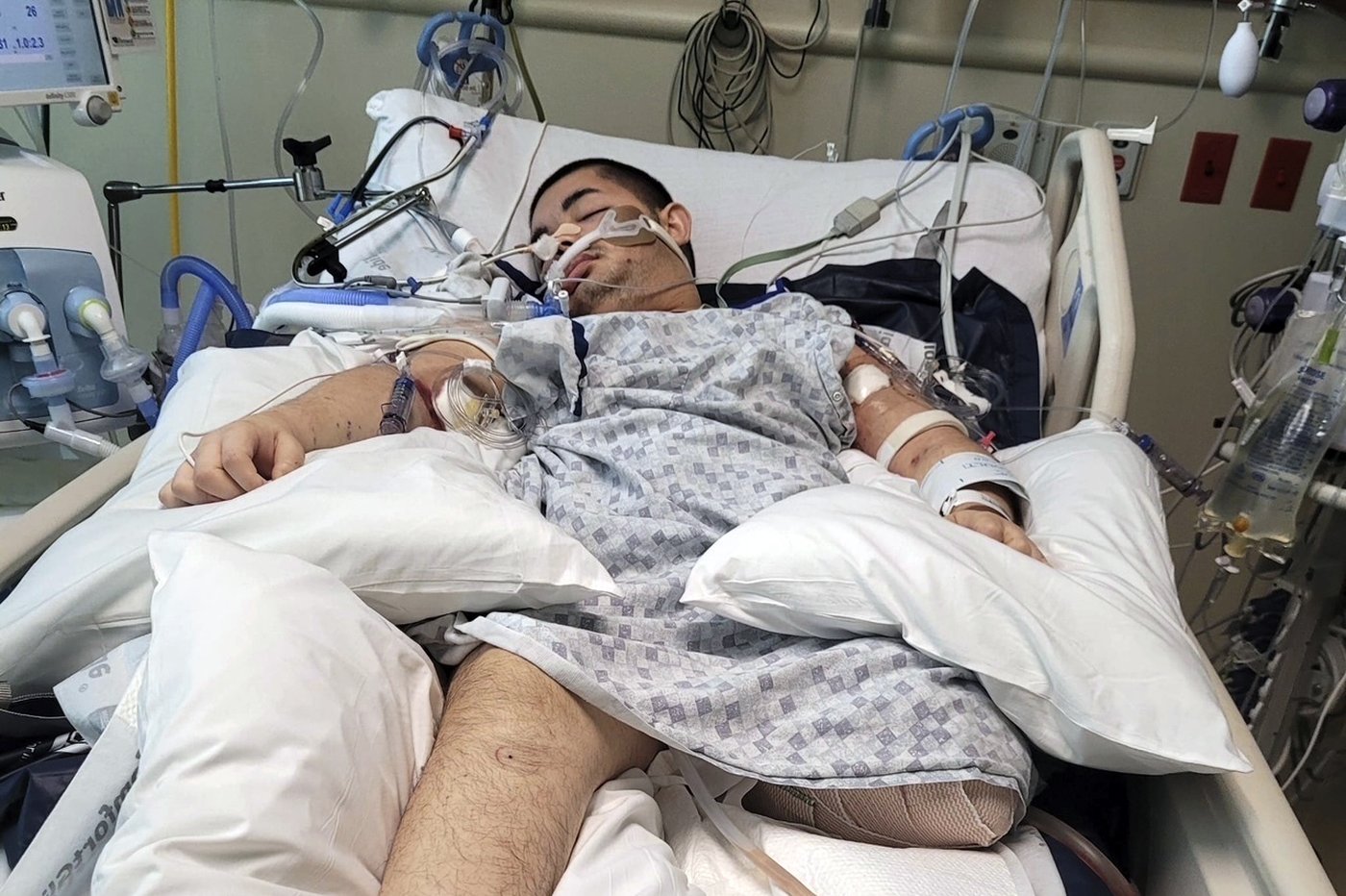 Intellectually disabled teen shot by Idaho police dies after being removed from life support | iNFOnews.ca