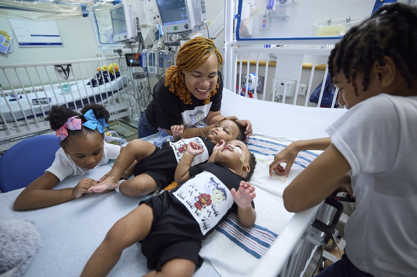 Twin boys born conjoined celebrate 1st birthday after separation surgery | iNFOnews.ca Twin boys born conjoined celebrate 1st birthday after separation surgery | iNFOnews.ca