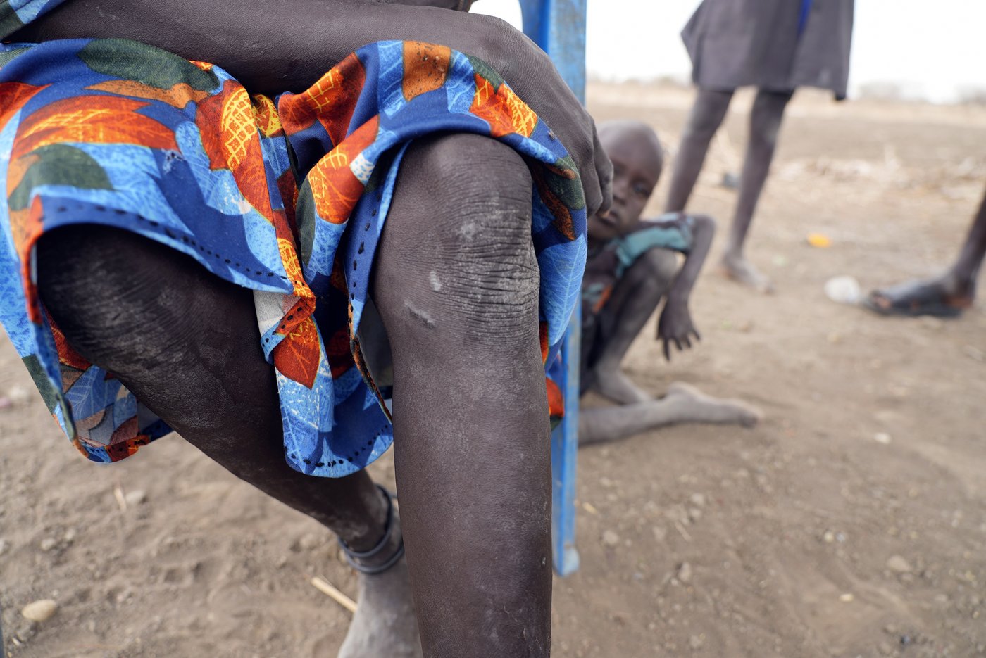 Jimmy Carter made eradicating Guinea worm disease a top mission | iNFOnews.ca
