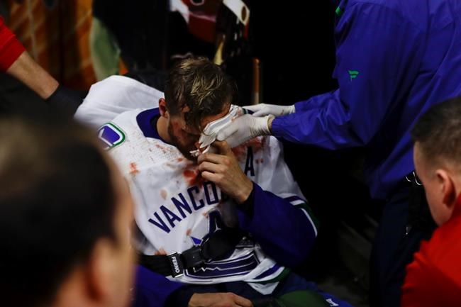 Canucks defenceman Edler sidelined by concussion | iNFOnews.ca