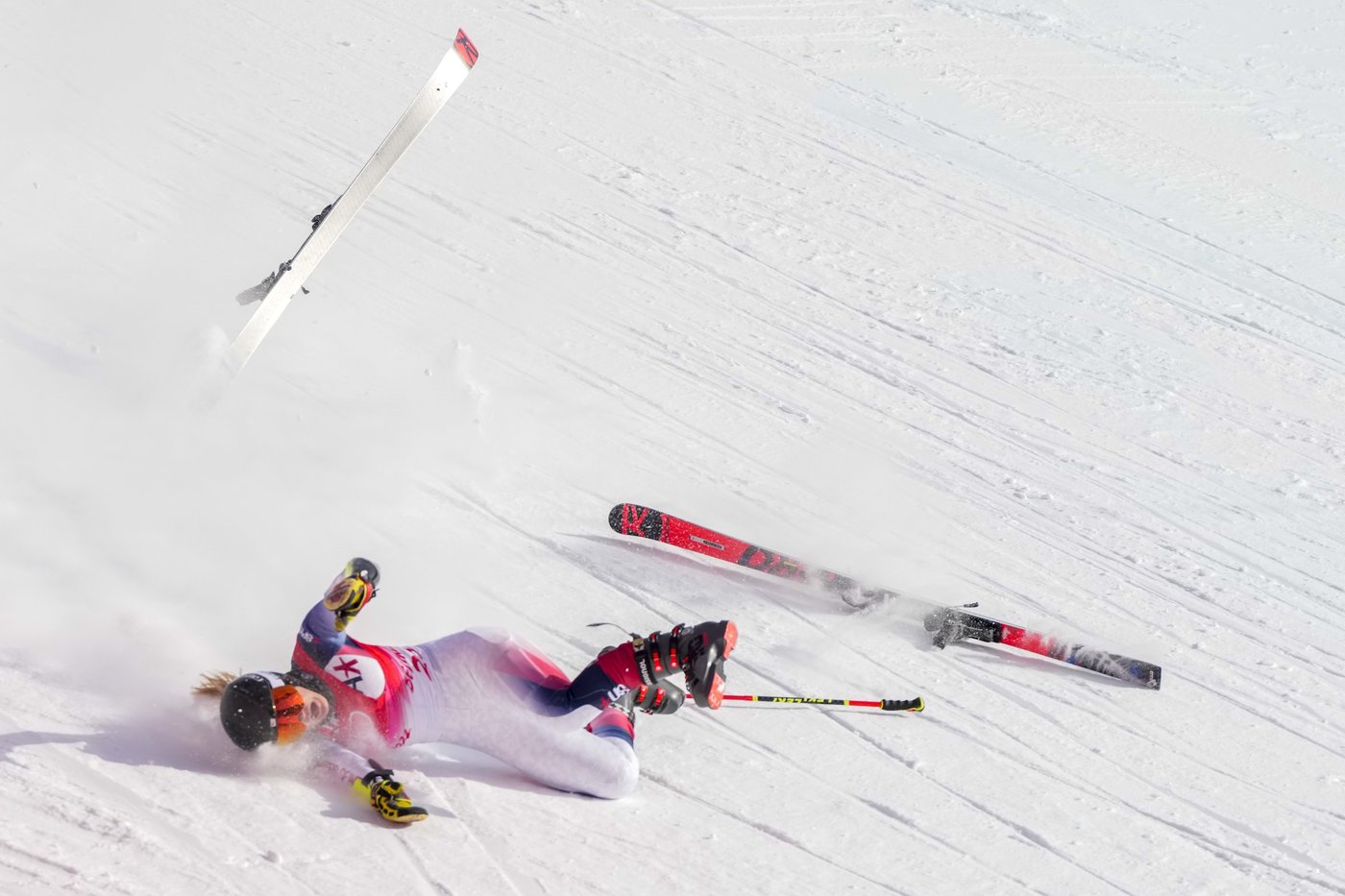 American skier Nina O'Brien ready for another comeback after breaking left leg twice | iNFOnews.ca