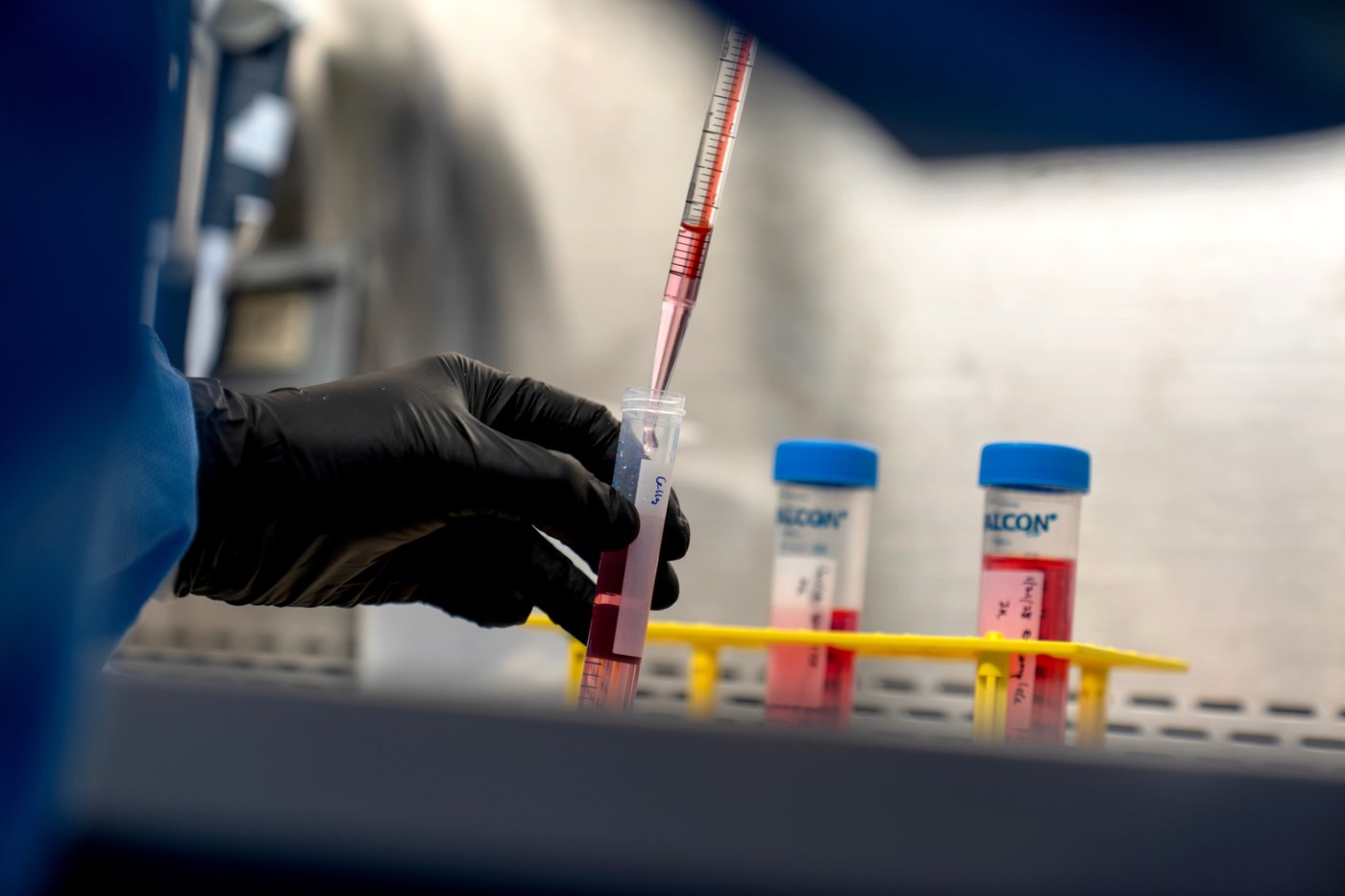 Lifelong drugs for autoimmune diseases don't work well. Now scientists are trying something new | iNFOnews.ca Lifelong drugs for autoimmune diseases don't work well. Now scientists are trying something new | iNFOnews.ca