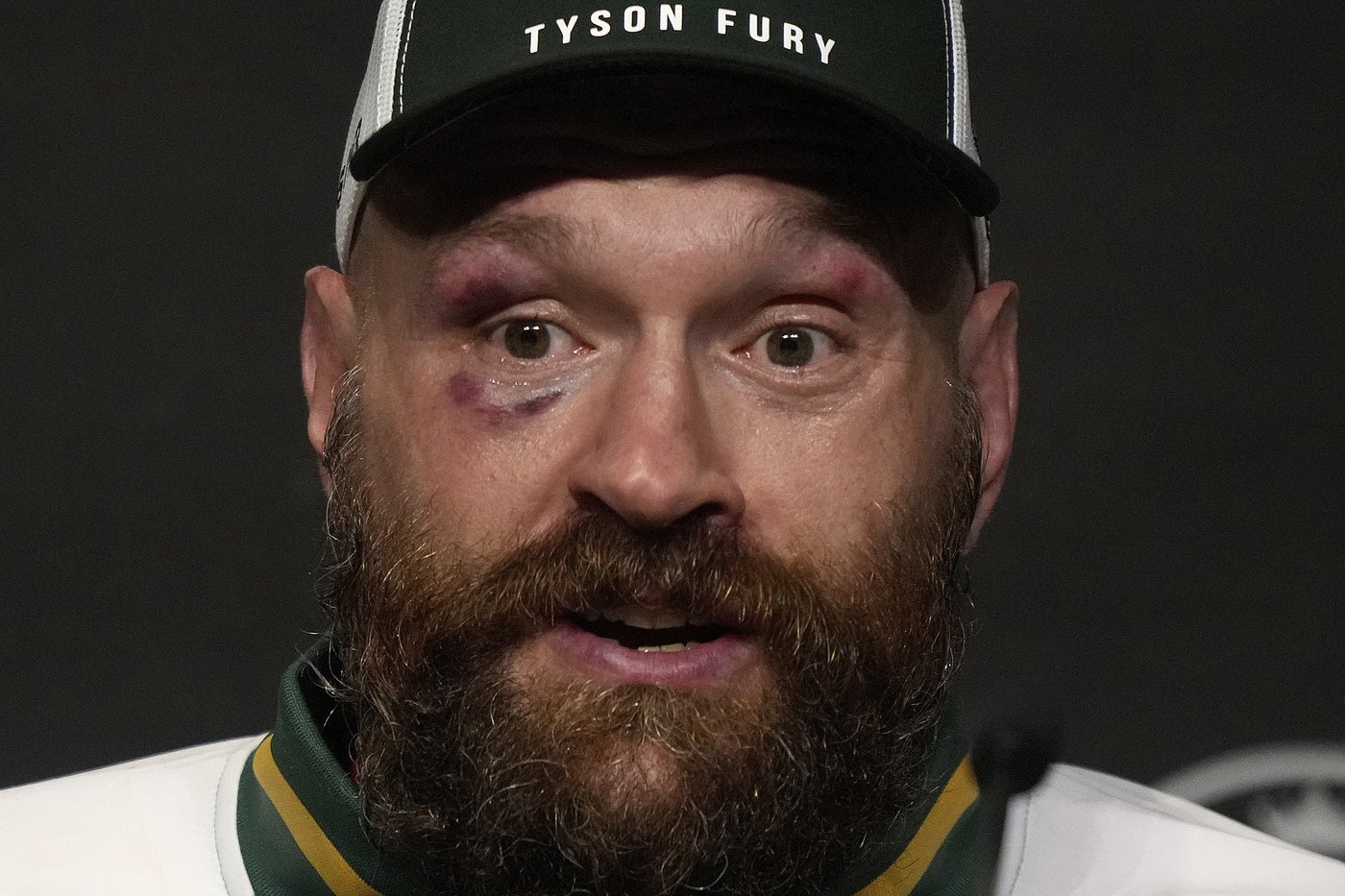 British heavyweight Tyson Fury announces retirement from boxing again, one month after Usyk defeat | iNFOnews.ca British heavyweight Tyson Fury announces retirement from boxing again, one month after Usyk defeat | iNFOnews.ca