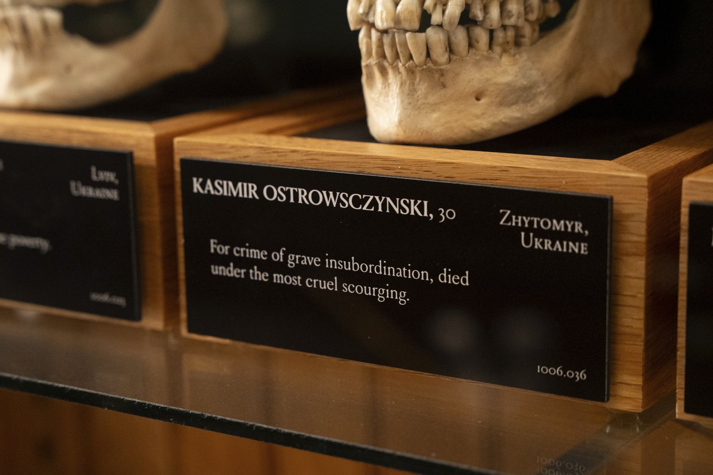 Medical museum in Philadelphia overhauls policies on human remains to meet modern ethical standards | iNFOnews.ca Medical museum in Philadelphia overhauls policies on human remains to meet modern ethical standards | iNFOnews.ca