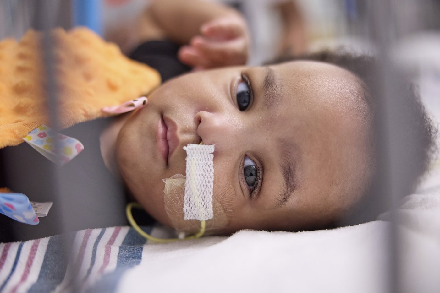 Twin boys born conjoined celebrate 1st birthday after separation surgery | iNFOnews.ca Twin boys born conjoined celebrate 1st birthday after separation surgery | iNFOnews.ca