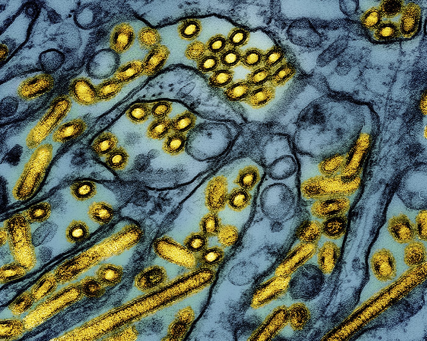 New York temporarily shutters bird markets after seven cases of avian flu are detected in NYC | iNFOnews.ca