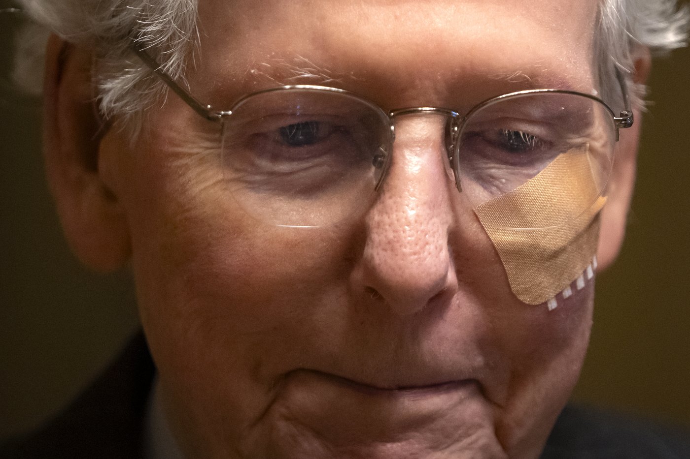 McConnell falls and sprains wrist after GOP luncheon, colleague says he is 'fine' | iNFOnews.ca McConnell falls and sprains wrist after GOP luncheon, colleague says he is 'fine' | iNFOnews.ca