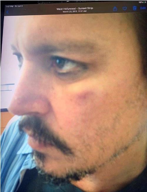 Depp's bodyguard says Amber Heard abused the Hollywood star | iNFOnews.ca Depp's bodyguard says Amber Heard abused the Hollywood star | iNFOnews.ca