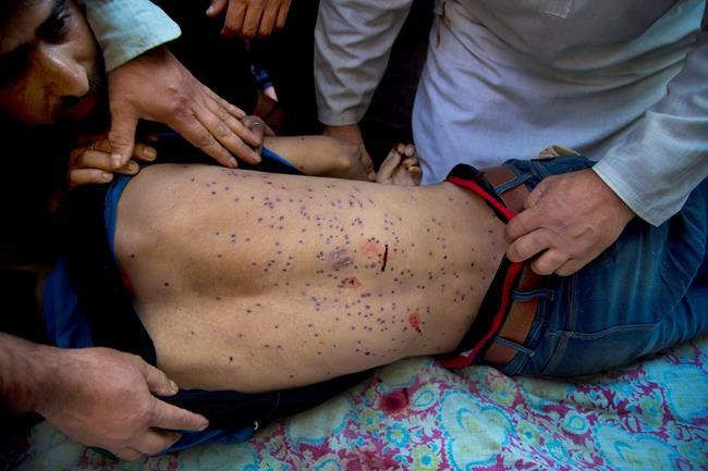 Rights group urges India to ban shotgun pellets in Kashmir | iNFOnews.ca CP684818432