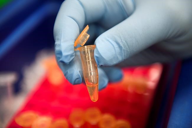 First blood test to help diagnose brain injuries gets US OK | iNFOnews.ca