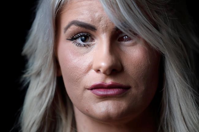 1 year after Vegas shooting, survivors describe 'new normal' | iNFOnews.ca