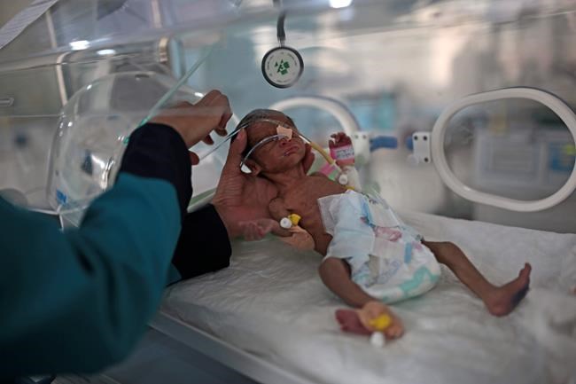 UN: Over 2 million Yemeni children may starve in 2021 | iNFOnews.ca UN: Over 2 million Yemeni children may starve in 2021 | iNFOnews.ca