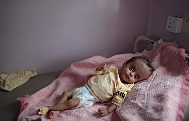 UN chief: Appeal for Yemen raises 'disappointing' $1.7B | iNFOnews.ca