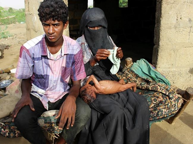UN agency warns time running out to prevent Yemen famine | iNFOnews.ca UN agency warns time running out to prevent Yemen famine | iNFOnews.ca
