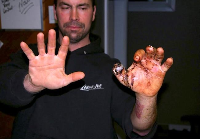 Gun maker's exploding rifle leaves trail of injured hunters | iNFOnews.ca