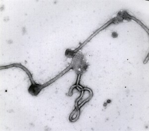 Experts starting to admit it may take vaccine to stop Ebola in West Africa | iNFOnews.ca CP30175415