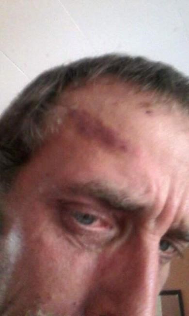 N.L. hunter suffers hoof-shaped bruise in brawl between man and moose | iNFOnews.ca