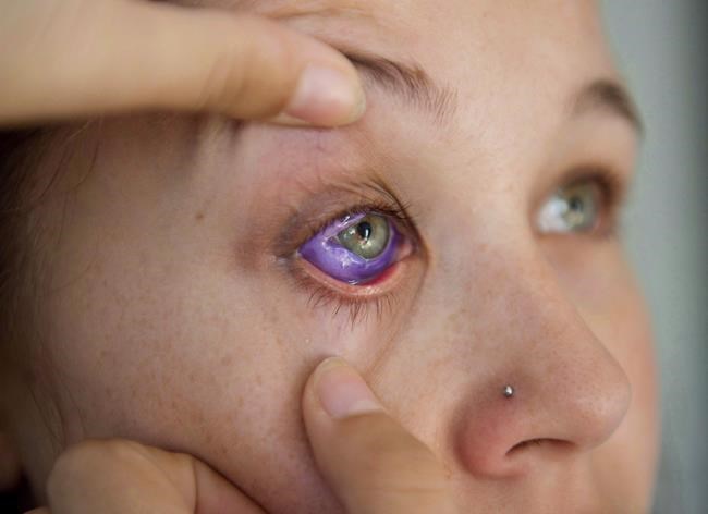 Ontario moves to ban eye tattooing, implanting eye jewelry | iNFOnews.ca