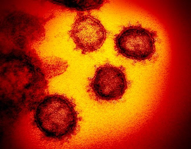 Three new coronavirus cases in Ontario, pushing provincewide total to 23 | iNFOnews.ca Three new coronavirus cases in Ontario, pushing provincewide total to 23 | iNFOnews.ca