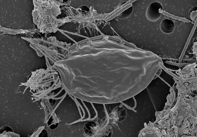 Halifax researchers say microbe reveals 'major new branch' of evolutionary tree | iNFOnews.ca Halifax researchers say microbe reveals 'major new branch' of evolutionary tree | iNFOnews.ca