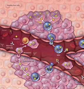Hitchhiking cold virus holds promise as cancer therapy, homes in on tumour: study | iNFOnews.ca Hitchhiking cold virus holds promise as cancer therapy, homes in on tumour: study | iNFOnews.ca