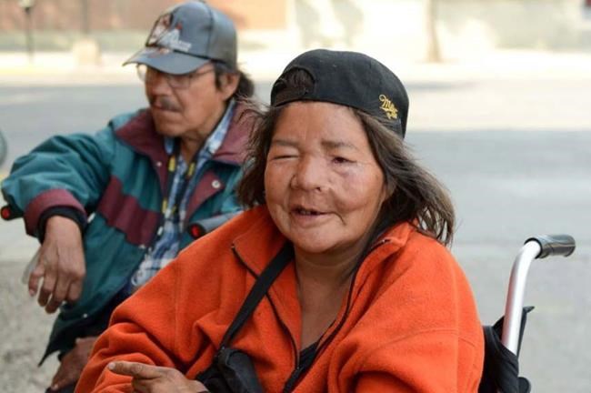 'It was very hard on her:' Woman assaulted, burned in 2014 alley attack dies | iNFOnews.ca 'It was very hard on her:' Woman assaulted, burned in 2014 alley attack dies | iNFOnews.ca