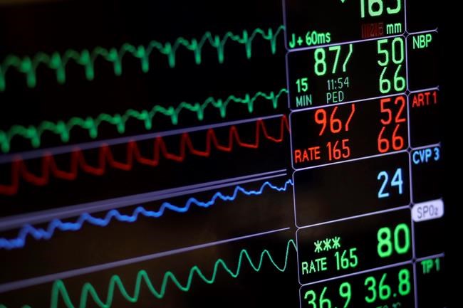 Assisted dying bill gets mixed reviews, raises fears of more restrictions | iNFOnews.ca Assisted dying bill gets mixed reviews, raises fears of more restrictions | iNFOnews.ca