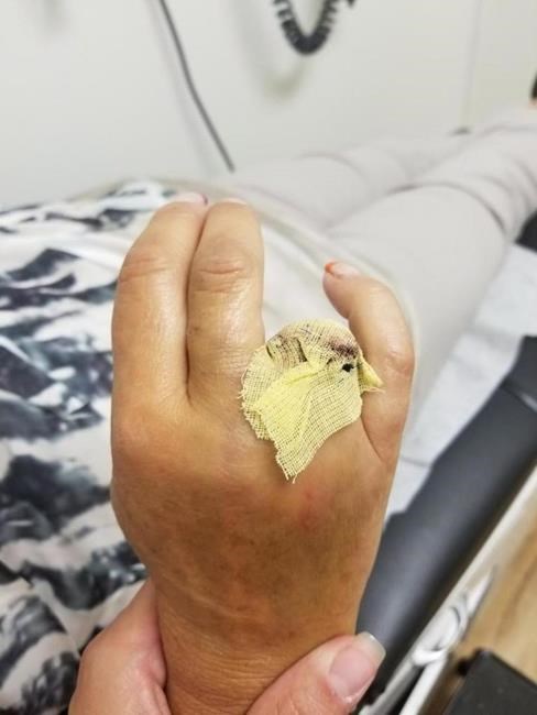 Woman has finger ripped off at West Edmonton Mall waterslide | iNFOnews.ca