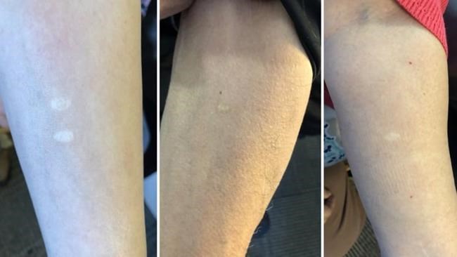 "Other people's skin:" Inuit sue government over medical experiments | iNFOnews.ca "Other people's skin:" Inuit sue government over medical experiments | iNFOnews.ca