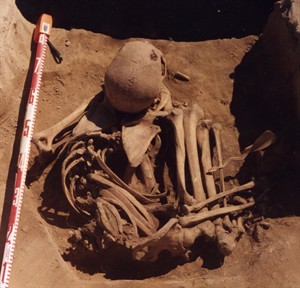 Saskatchewan scientist finds ancient cancer in man who died 4,500 years ago | iNFOnews.ca CP30966793