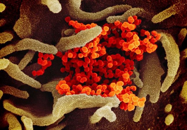 Alberta woman home after cruise first presumptive case of new coronavirus | iNFOnews.ca CP1156406020