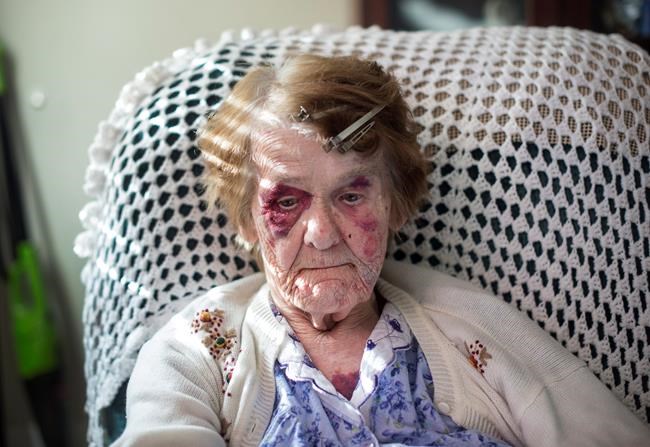 'I was scared to death:' Assault leaves 85-year-old woman nervous | iNFOnews.ca