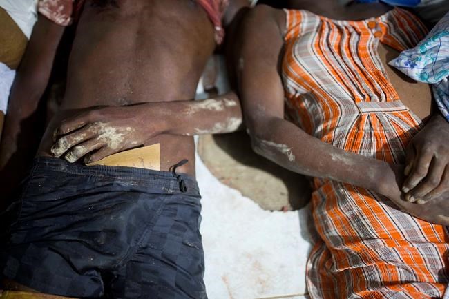 Death toll in Haiti earthquake rises to 15; 333 injured | iNFOnews.ca Death toll in Haiti earthquake rises to 15; 333 injured | iNFOnews.ca