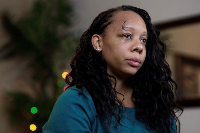 Video: Florida police laugh after shooting rubber bullets | iNFOnews.ca Video: Florida police laugh after shooting rubber bullets | iNFOnews.ca