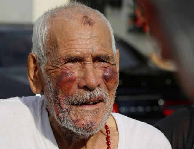 Correction: Elderly Man Beaten story | iNFOnews.ca Correction: Elderly Man Beaten story | iNFOnews.ca