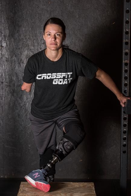 Flesh-eating bacteria claimed vet's limbs, but not her drive | iNFOnews.ca