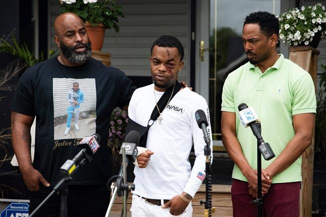 2 charged in Iowa assault that NAACP says was racist | iNFOnews.ca