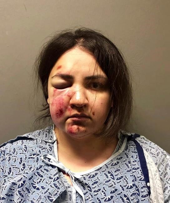 Mother suspected of killing baby, tossing son from landing | iNFOnews.ca