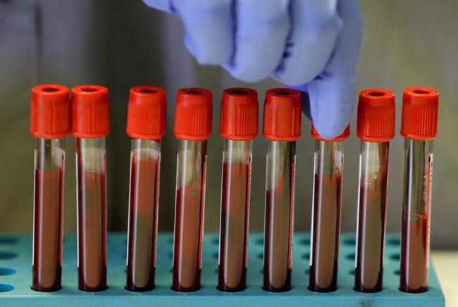 UK scientists to immunize hundreds with coronavirus vaccine | iNFOnews.ca UK scientists to immunize hundreds with coronavirus vaccine | iNFOnews.ca