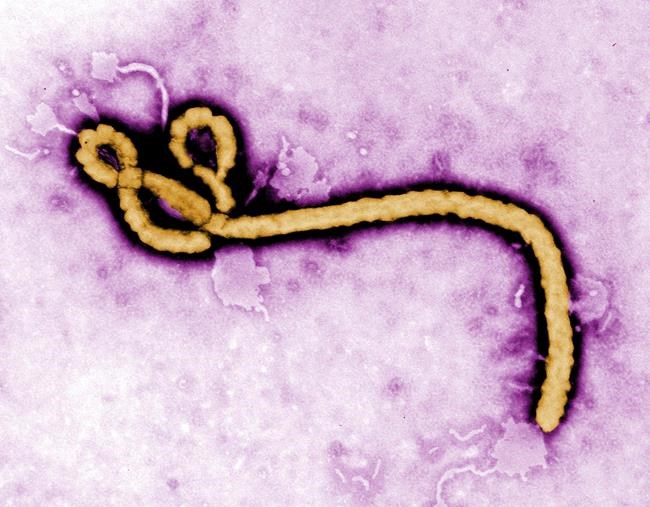 The Latest: Congo announces 11 new confirmed Ebola cases | iNFOnews.ca