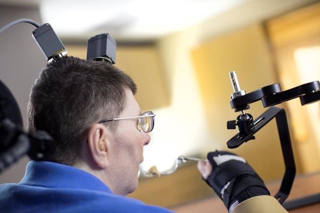 Brain and arm implants help paralyzed US man feed himself | iNFOnews.ca