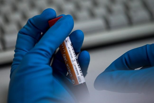 Russia's lab wizard created drug cocktails but caught cheats | iNFOnews.ca