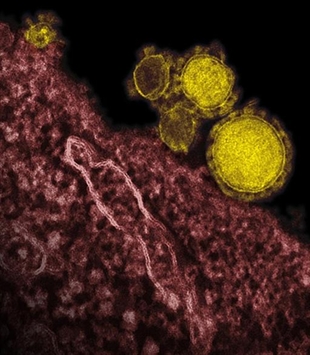US MERS case spread disease to a contact; first onward spread in North America | iNFOnews.ca