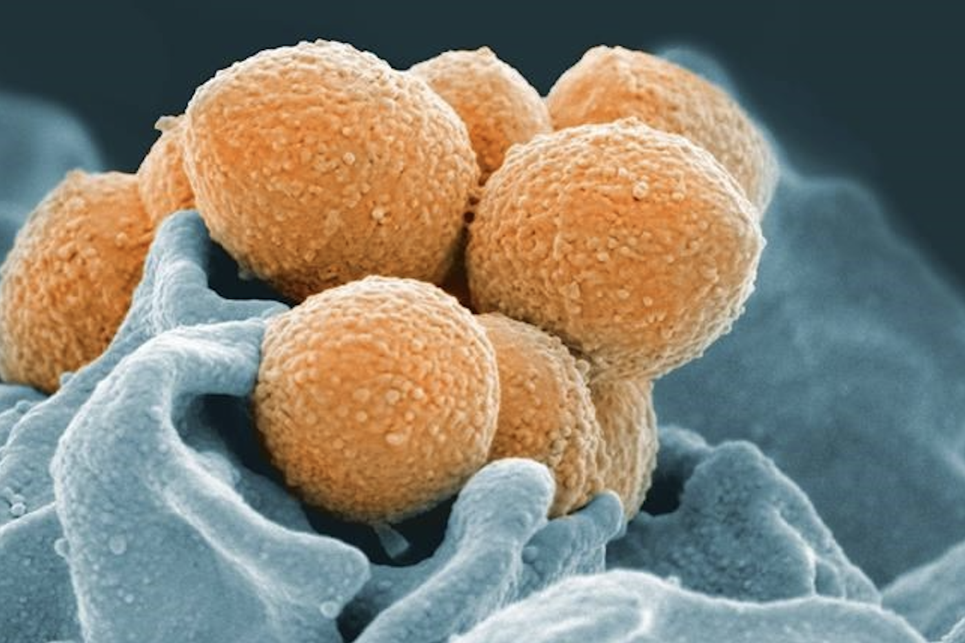 Four children with strep A have died in BC in the past month | iNFOnews.ca