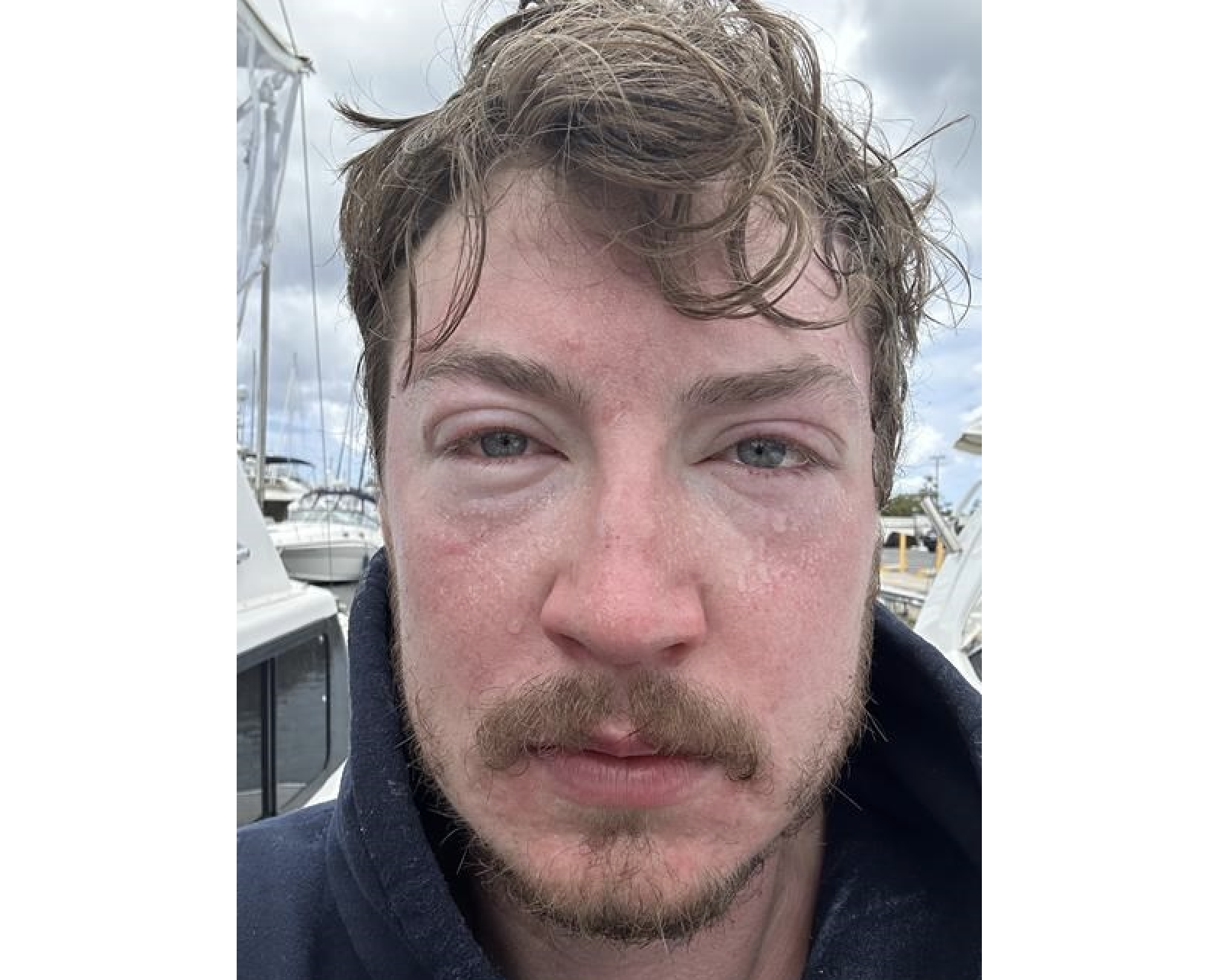 'Like a hot iron': Kelowna man's ultra-marathon Hawaiian swim is scuttled by jellyfish | iNFOnews.ca 'Like a hot iron': Kelowna man's ultra-marathon Hawaiian swim is scuttled by jellyfish | iNFOnews.ca